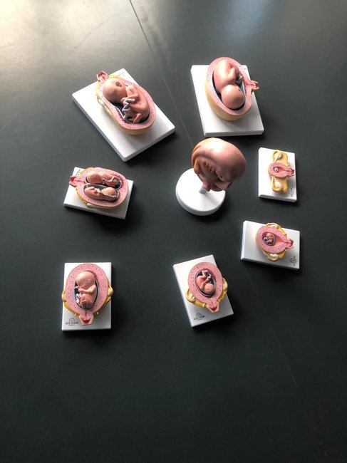 Embryo.jpg