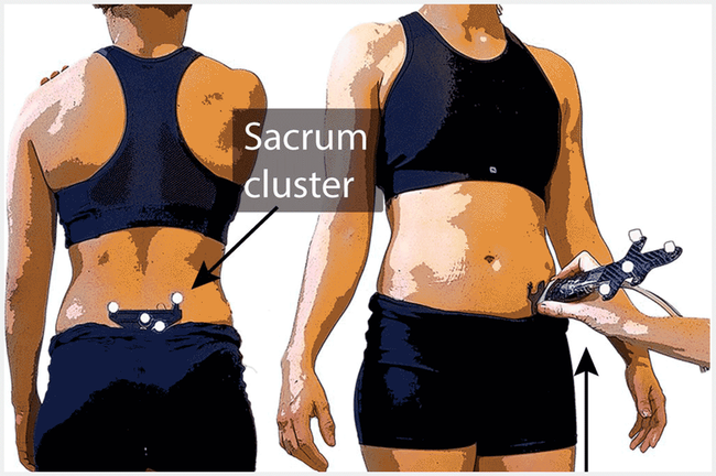 Sacrum cluster